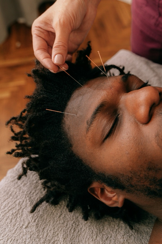 Facial acupuncture treatment, Dr. Crystal Rose Tank
